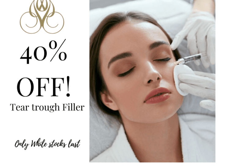 40% off Tear trough filler! - The Lotus Institute