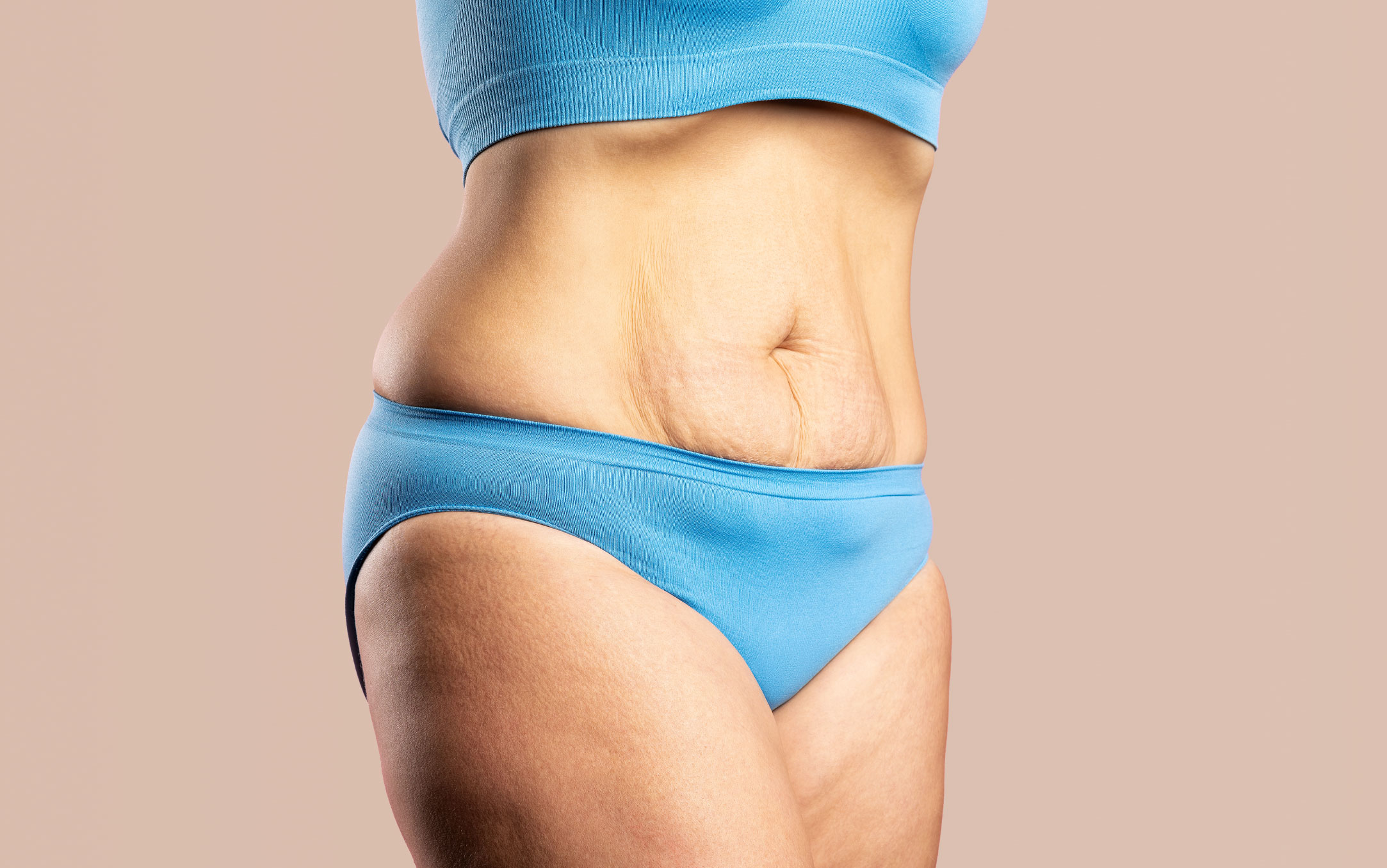 How to Tighten Loose and Sagging Skin After Weight Loss Surgery